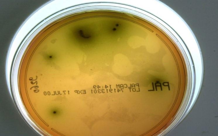 listeria, listériose, Afrique du Sud