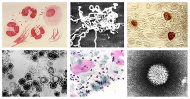 différents types de bacteries