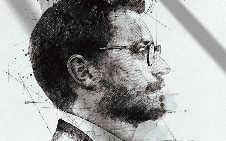 Combien coûte une greffe de cheveux en Turquie ?