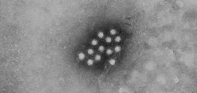 Virus hépatite A