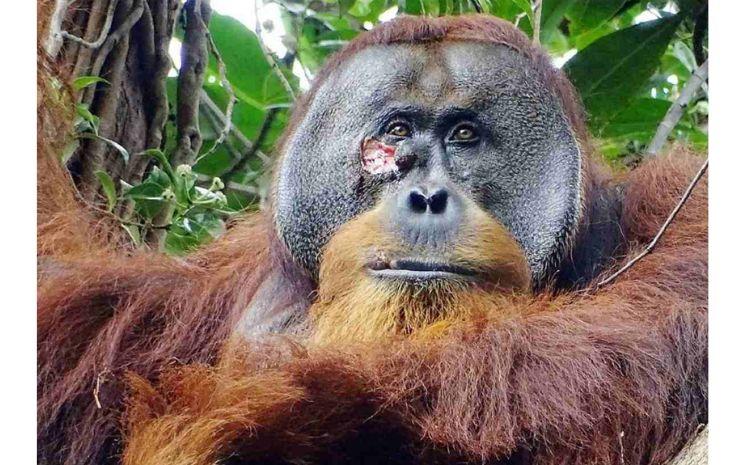 orang-blessure