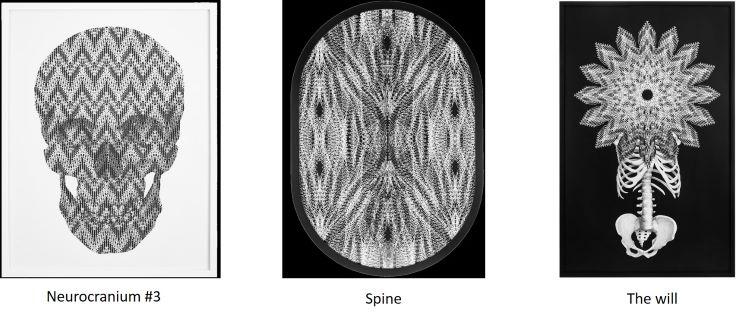Mujahidin Nurrahman Neurocranium Spine The will