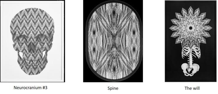 Mujahidin Nurrahman Neurocranium Spine The will