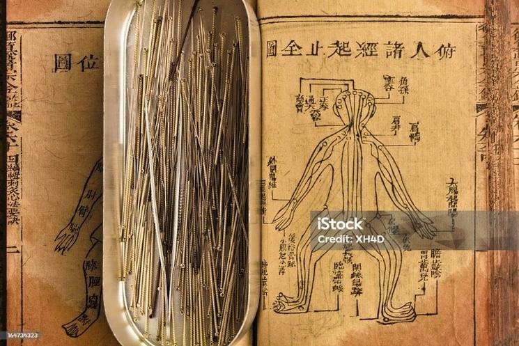 L'acupuncture est un des cinq piliers de la médecine traditionnelle chinoise.