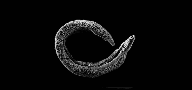 Le gouvernement birman intensifie sa lutte contre la Schistosomiase