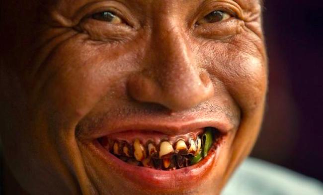 Résultats positifs pour la campagne anti-bétel de 2017 en Birmanie