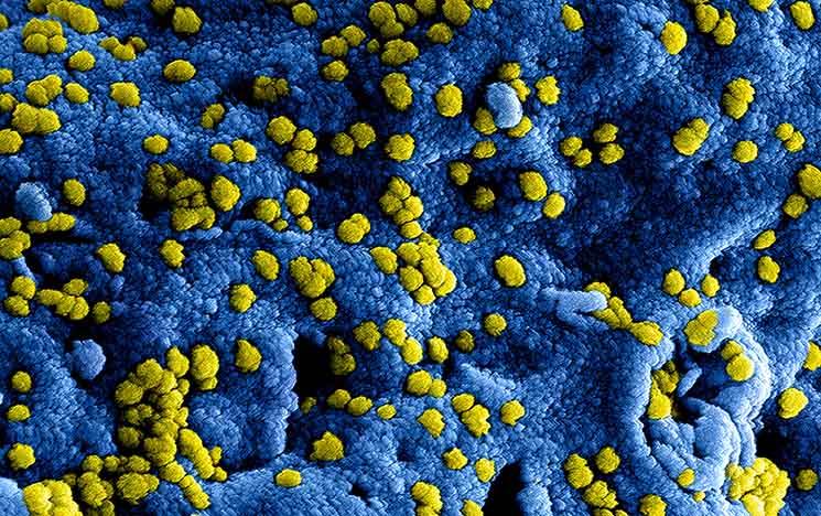 coronavirus covid-19