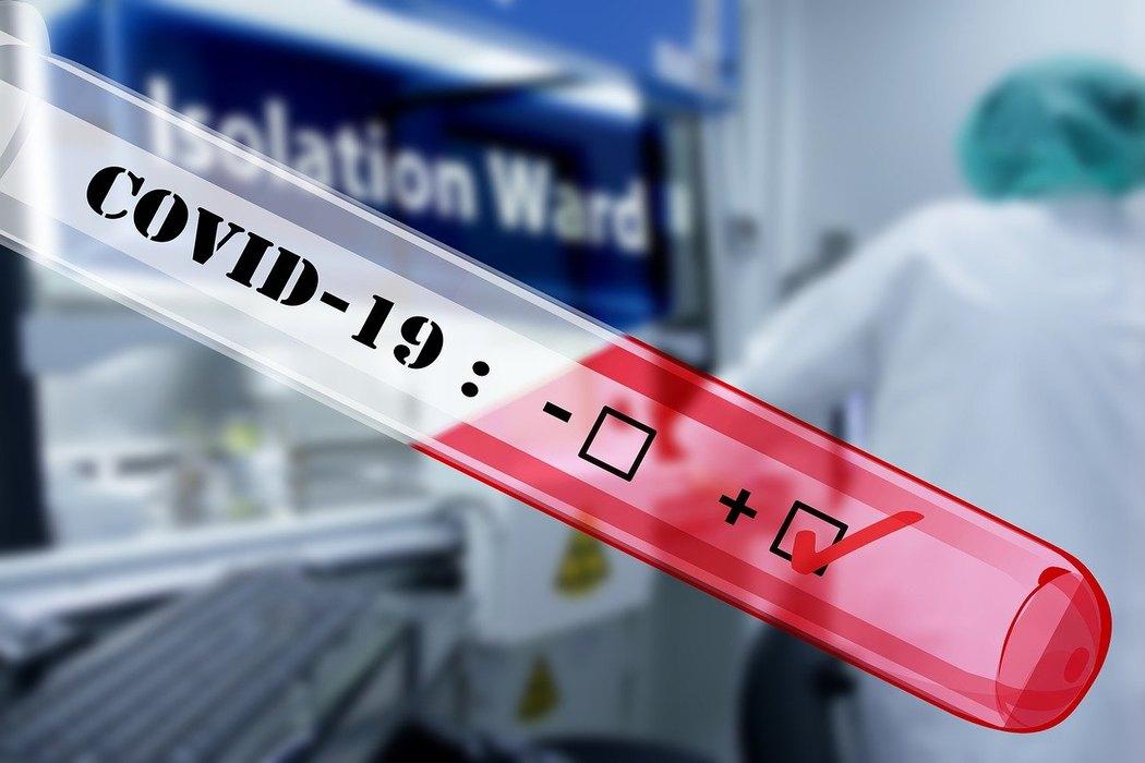 koronavirus-covid-19-epidemija-14