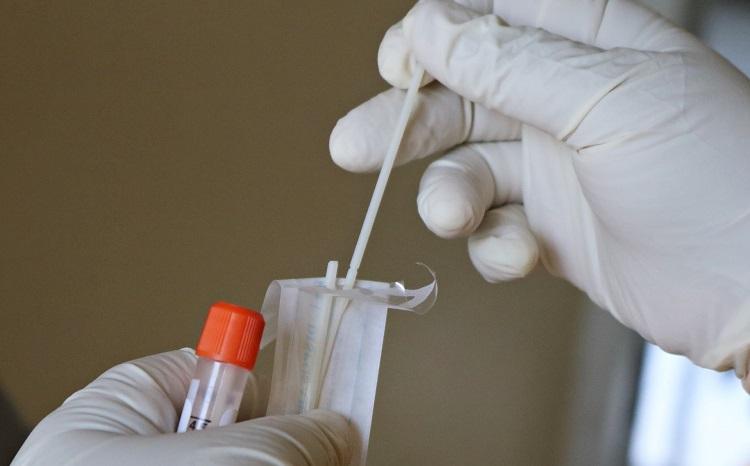 test autodépistage covid