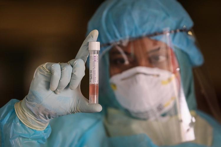 Covid-19 nouvelle souche variant Sud-Africain