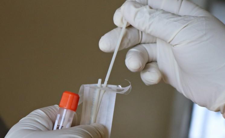 échantillon d'un test PCR contre le Covid-19
