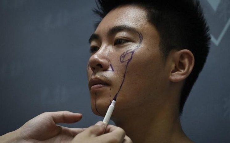 chirurgie esthétique en Chine