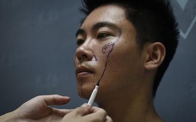 chirurgie esthétique en Chine