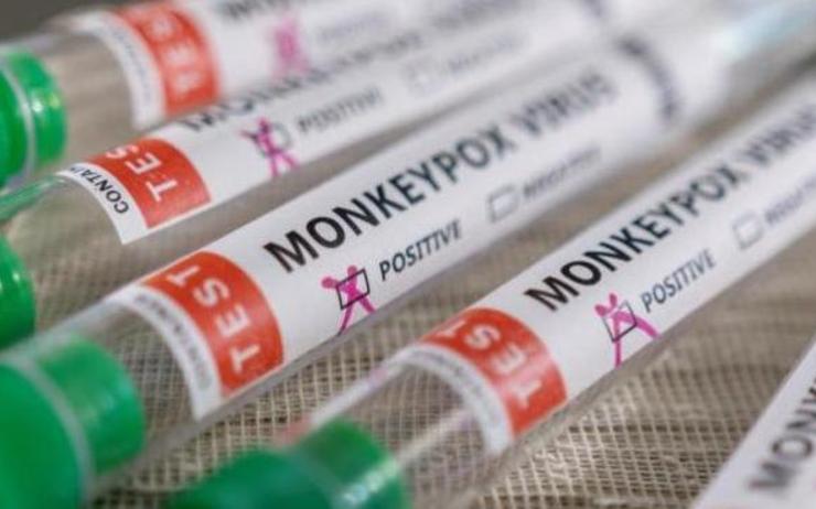 pipettes variole du singe