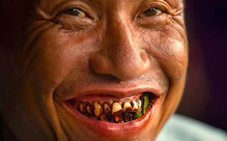 Résultats positifs pour la campagne anti-bétel de 2017 en Birmanie