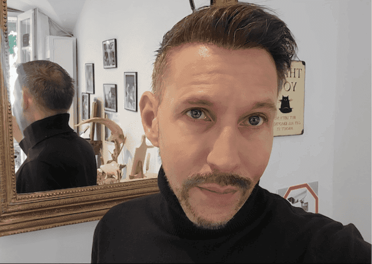 greffe-cheveux-istanbul-yohann-apres-6mois-portrait