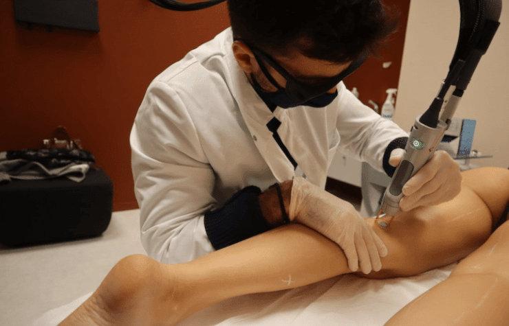 Laser dermatologique : 3 erreurs qui ruinent 40% des traitements