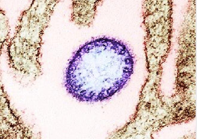 le Cambodge vigilant face au virus Nipah