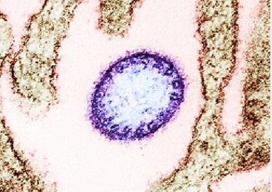 le Cambodge vigilant face au virus Nipah