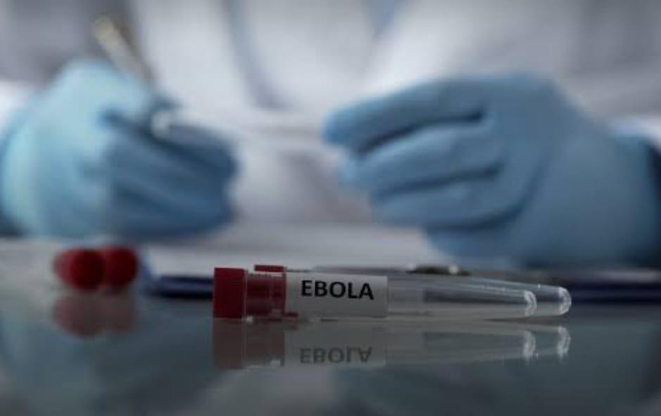 Image de laboratoire d'analyse du virus EBOLA