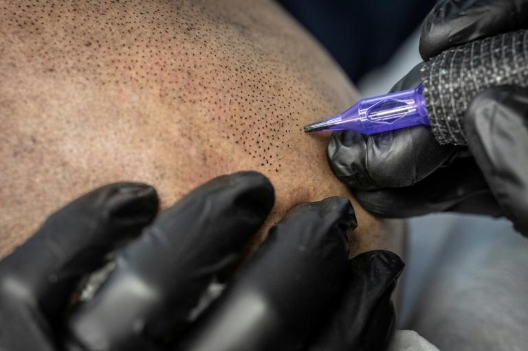 Art ou médecine? Au Japon, le tatouage cosmétique cherche sa voie
