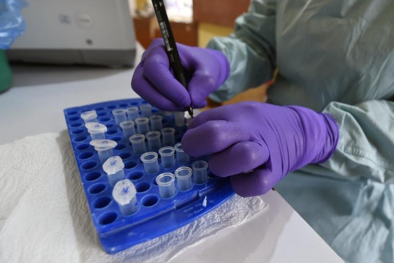 Au Nigeria, le "choc" après l'annonce d'un premier cas d'Ebola de souche Bundibugyo