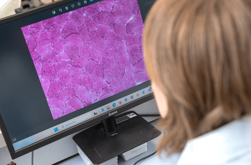 Histopathologie © Jean Yves Seguy - AFM Téléthon