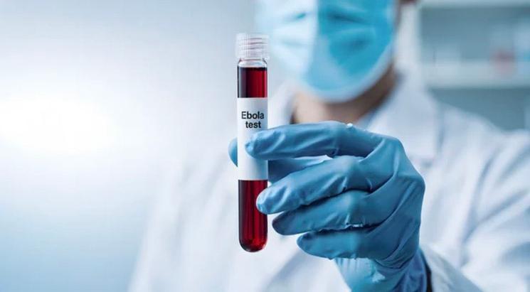 Test Ebola