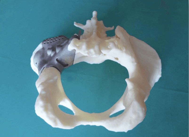 Pelvis 3D