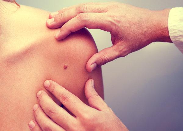 medecin grain beaute lesion