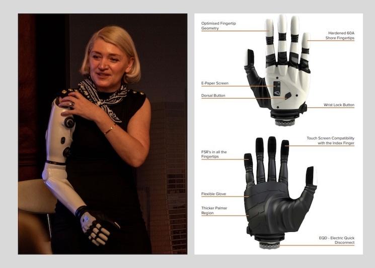 La technologie COVVI dans la main de Sarah de Lagarde