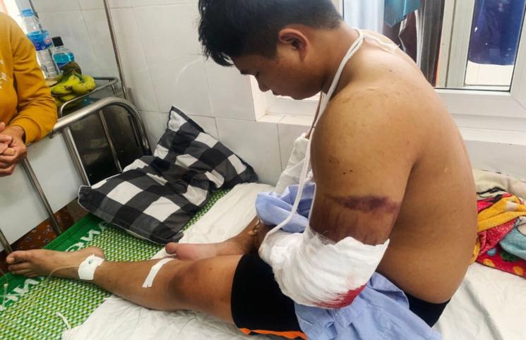 La victime au bras cassé au Vietnam