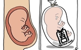 foetus thailande 
