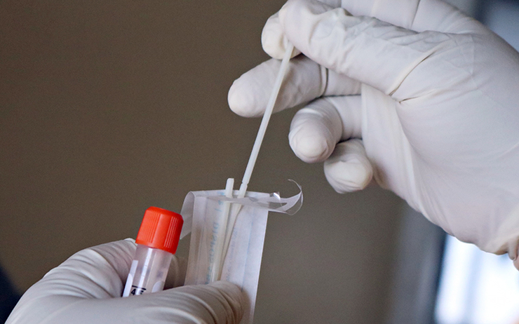 Pour entrer en Nouvelle-Calédonie, le protocole sanitaire contre la propagation de la Covid-19 requiert d’être muni d’un Test PCR Négatif pour monter dans l’avion.