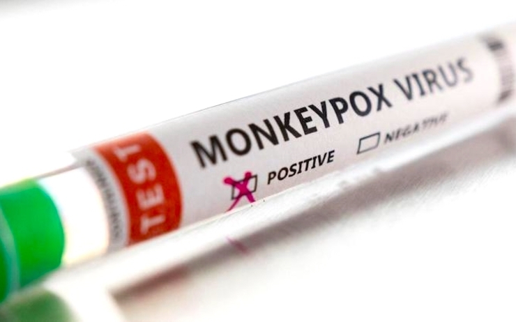Un test pour le premier cas de variole du singe dans la Communauté valencienne